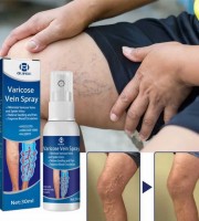 Varicose Veins Treatment Spray!